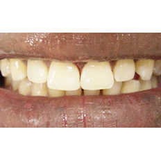 Detail of man's smile