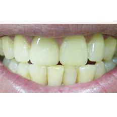 Detail of woman's smile