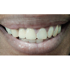 Detail of a man's mouth smiling